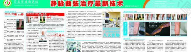 靜脈曲張新療法觀點論述與解析